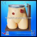 ISO Advanced Ostomy Care Simulator, Ostomy Training Model